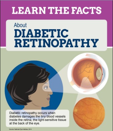 Diabetic Retinopathy Infograph NEI